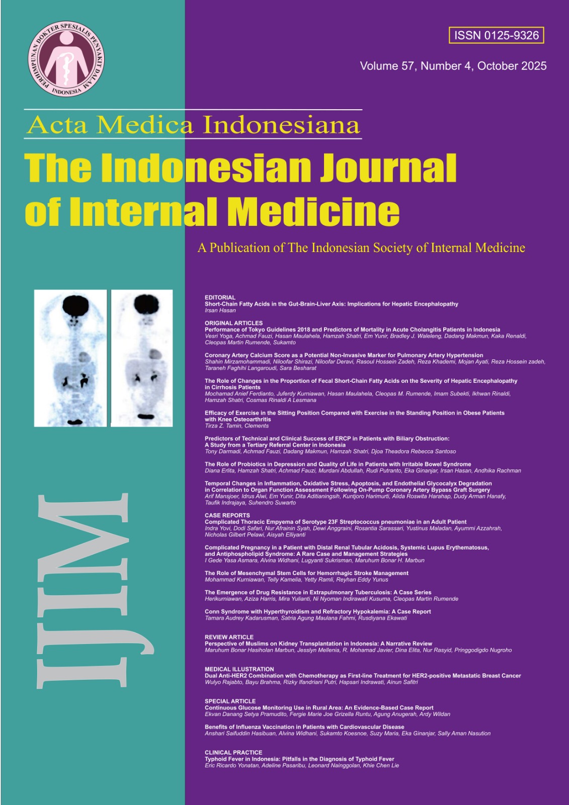 					View Vol. 57 No. 4 (2025): Acta Medica Indonesiana
				