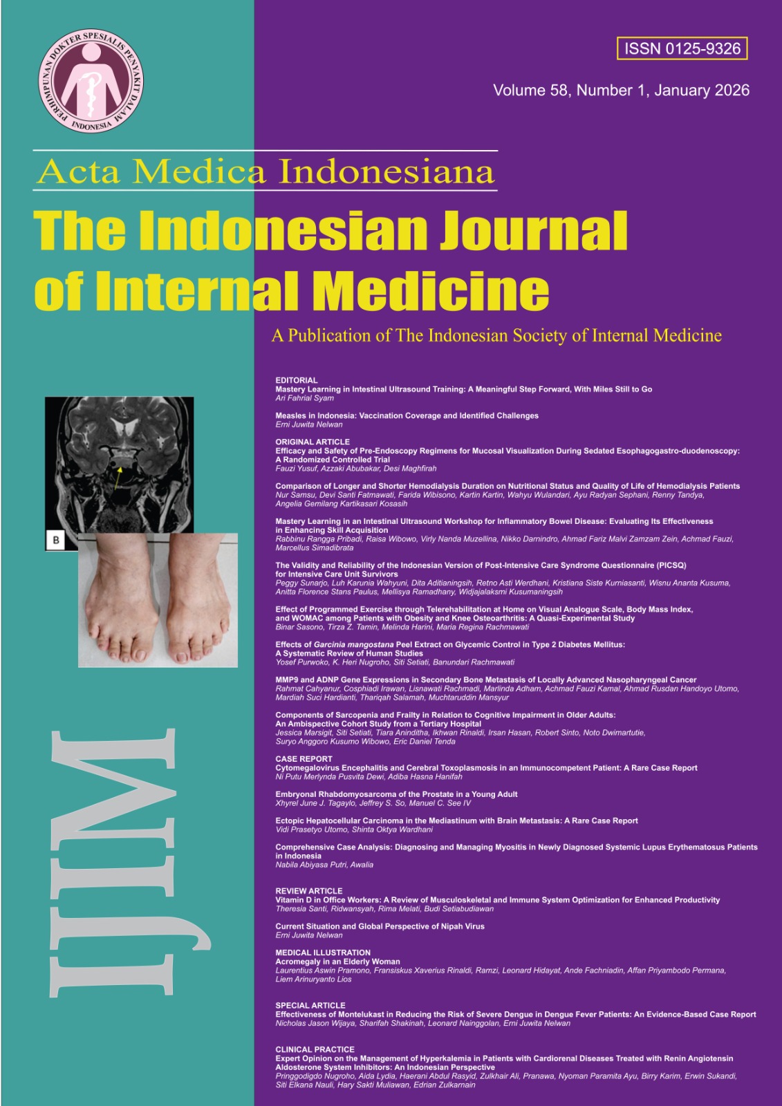 					View Vol. 58 No. 1 (2026): Acta Medica Indonesiana
				
