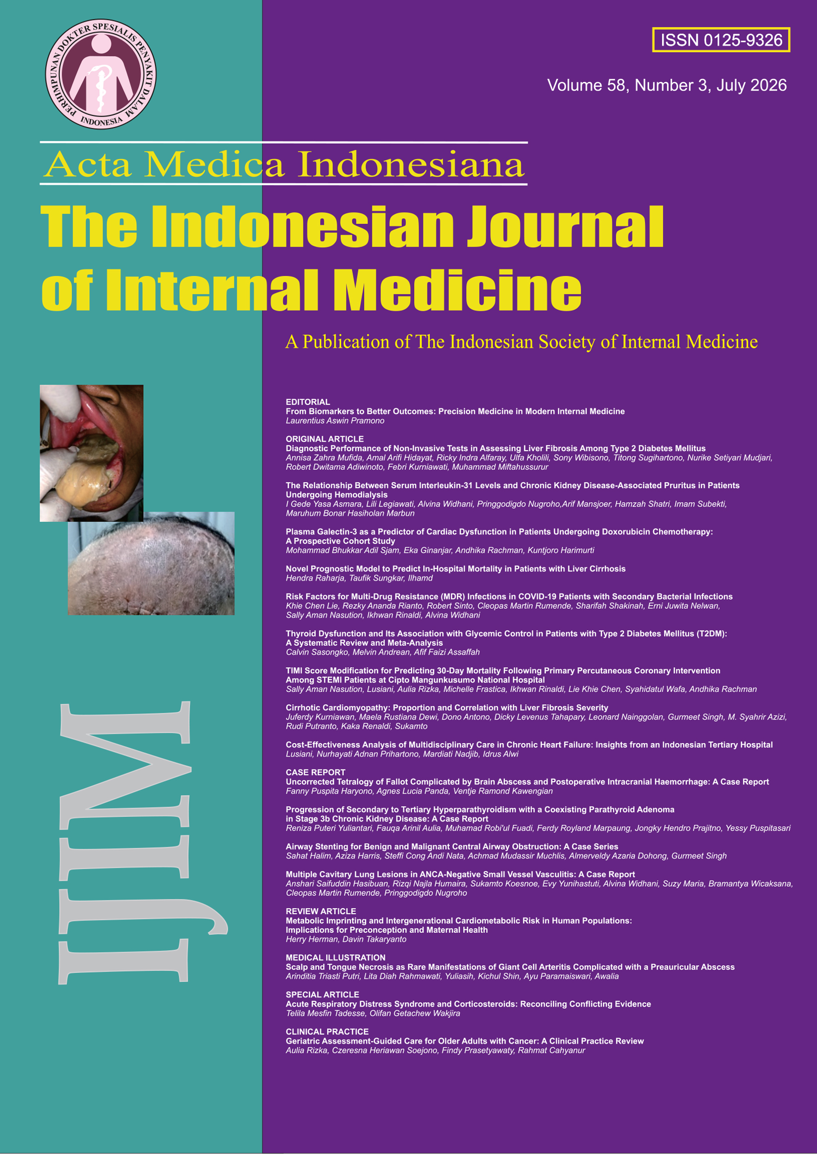 					View Vol. 58 No. 3 (2026): Acta Medica Indonesiana
				